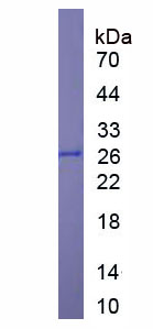 Recombinant Glutathione S Transferase (GST)