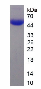 Recombinant Nucleoprotein, SARS-CoV (NP)