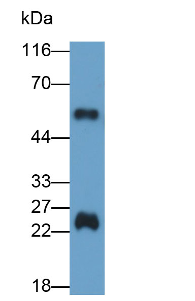 HRP-Linked Rabbit Anti-Rat IgG Polyclonal Antibody