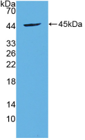 Active Brain Derived Neurotrophic Factor (BDNF)