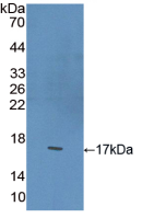 Active Brain Derived Neurotrophic Factor (BDNF)