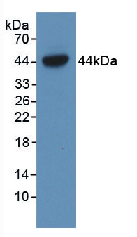 Active Endocrine Gland Derived Vascular Endothelial Growth Factor (EG-VEGF)