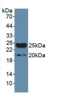 Active Interferon Alpha (IFNa)