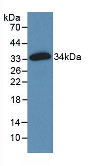 Active Fibronectin (FN)