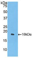 Active Interferon Gamma (IFNg)