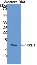 Active Interferon Gamma (IFNg)