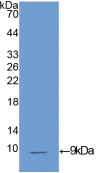 Active Insulin Like Growth Factor 1 (IGF1)