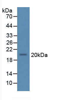 Active Interleukin 11 (IL11)