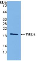 Active Interleukin 18 (IL18)