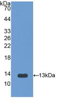 Active Interleukin 1 Receptor Type I (IL1R1)