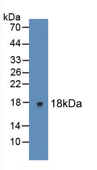 Active Interleukin 2 (IL2)