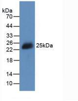 Active Interleukin 2 (IL2)