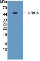 Active Interleukin 6 (IL6)