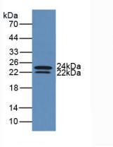 Active Interleukin 6 (IL6)