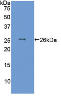 Active Interleukin 6 (IL6)