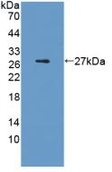 Active Interleukin 6 (IL6)