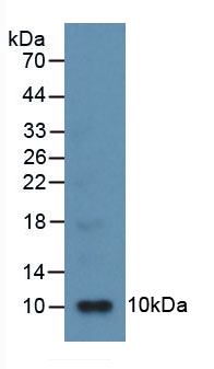 Active Interleukin 8 (IL8)