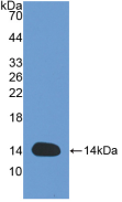 Active Interleukin 8 (IL8)