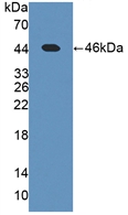 Active Leptin (LEP)