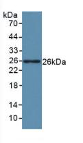 Active Leukemia Inhibitory Factor (LIF)