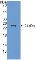 Active Colony Stimulating Factor 1, Macrophage (MCSF)