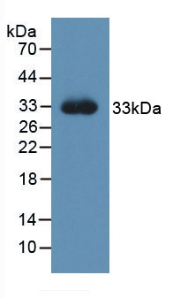 Active Nerve Growth Factor (NGF)