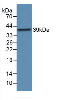 Active Prokineticin 2 (PK2)