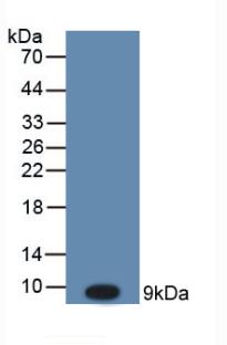 Active Stromal Cell Derived Factor 1 (SDF1)