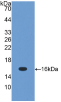 Active Transforming Growth Factor Beta 1 (TGFb1)