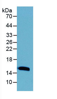 Active Transforming Growth Factor Beta 1 (TGFb1)