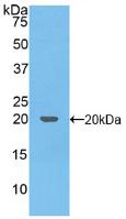 Active Tumor Necrosis Factor Related Apoptosis Inducing Ligand (TRAIL)