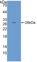 Active Ribonuclease P (RNASEP)