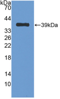 Active Nesfatin 1 (NES1)