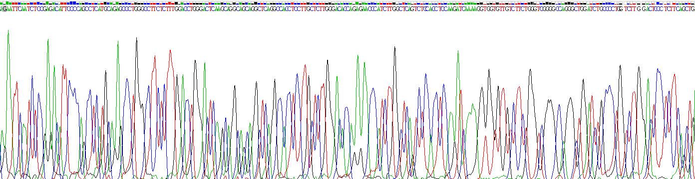 Active Sex Hormone Binding Globulin (SHBG)