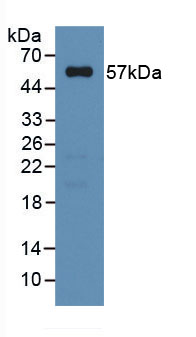 Active High Mobility Group Protein 1 (HMGB1)