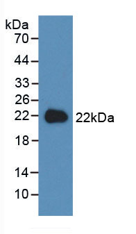 Active High Mobility Group Protein 1 (HMGB1)