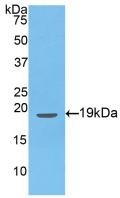 Active Endothelin 1 (EDN1)