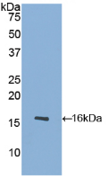 Active Platelet Derived Growth Factor Subunit A (PDGFA)