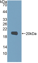 Active Matrix Metalloproteinase 9 (MMP9)