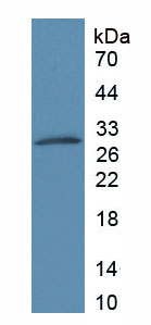 Active Matrix Metalloproteinase 9 (MMP9)