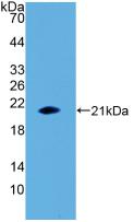 Active Interleukin 1 Beta (IL1b)