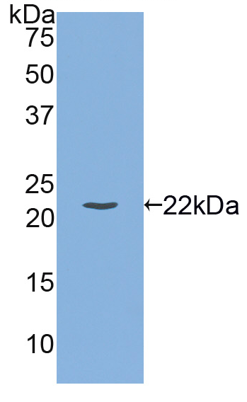 Active Interleukin 1 Beta (IL1b)