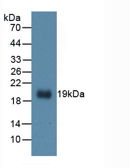 Active Interleukin 1 Beta (IL1b)