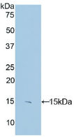 Active S100 Calcium Binding Protein B (S100B)