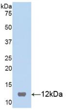 Active S100 Calcium Binding Protein B (S100B)