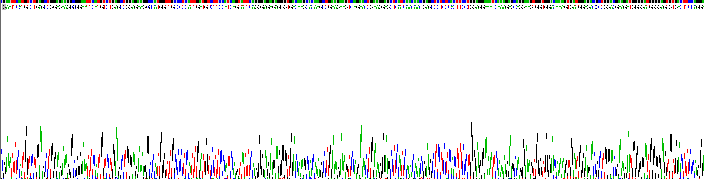 Active S100 Calcium Binding Protein B (S100B)