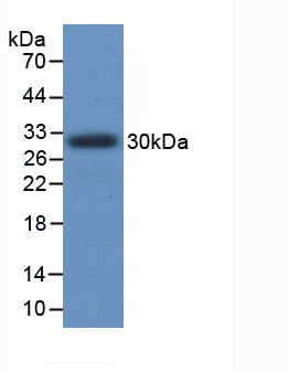 Active Procollagen III N-Terminal Propeptide (PIIINP)