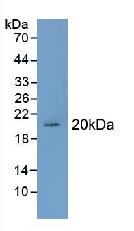 Active Calmodulin (CAM)