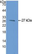 Active Glutathione S Transferase Mu 1 (GSTM1)