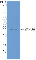 Active Interleukin 7 (IL7)